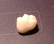 歯歯歯